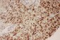 Anti-P53 Picoband Antibody